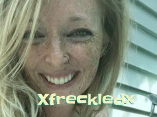 Xfreckledx